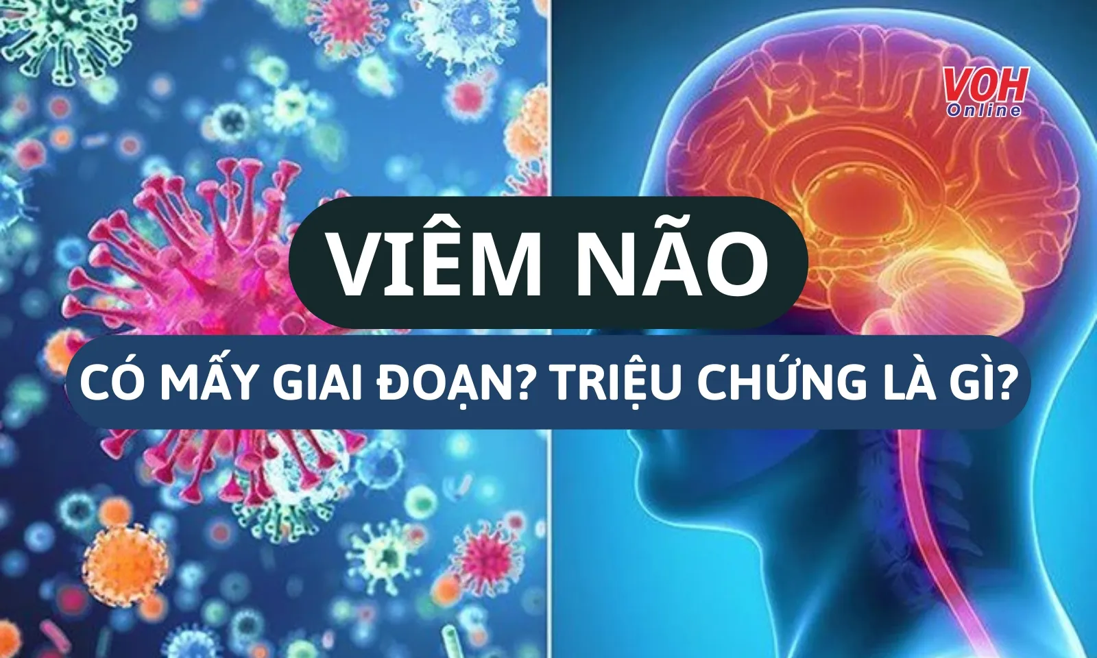 Viêm não diễn tiến qua mấy giai đoạn? Triệu chứng thường gặp là gì?