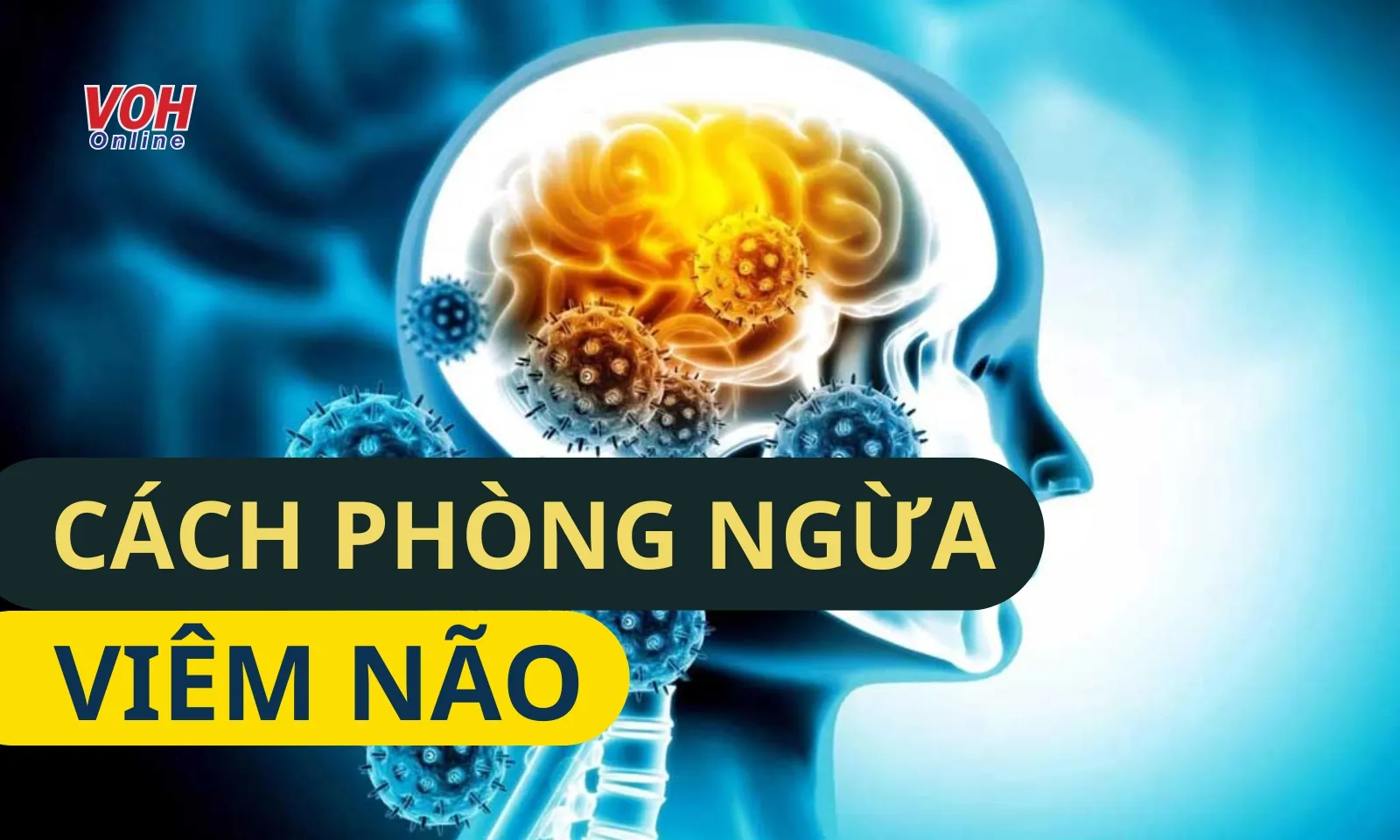 Những cách phòng bệnh viêm não cần biết