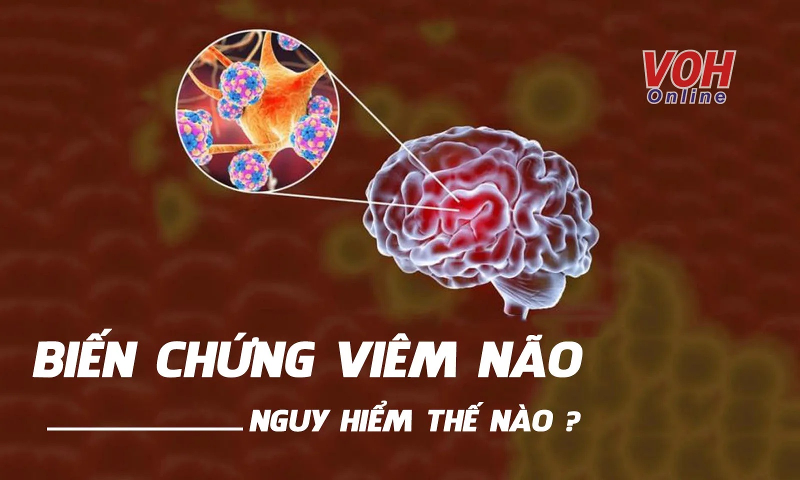 Sự nguy hiểm của bệnh viêm não do virus khi không được điều trị
