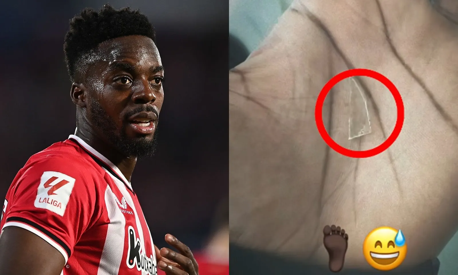 Máy chạy La Liga thi đấu suốt 2 năm với mảnh kính vỡ trong chân