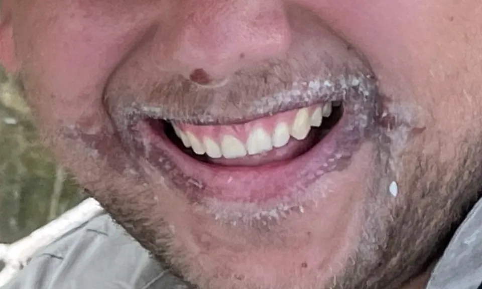 bong-cap-do-3-270524