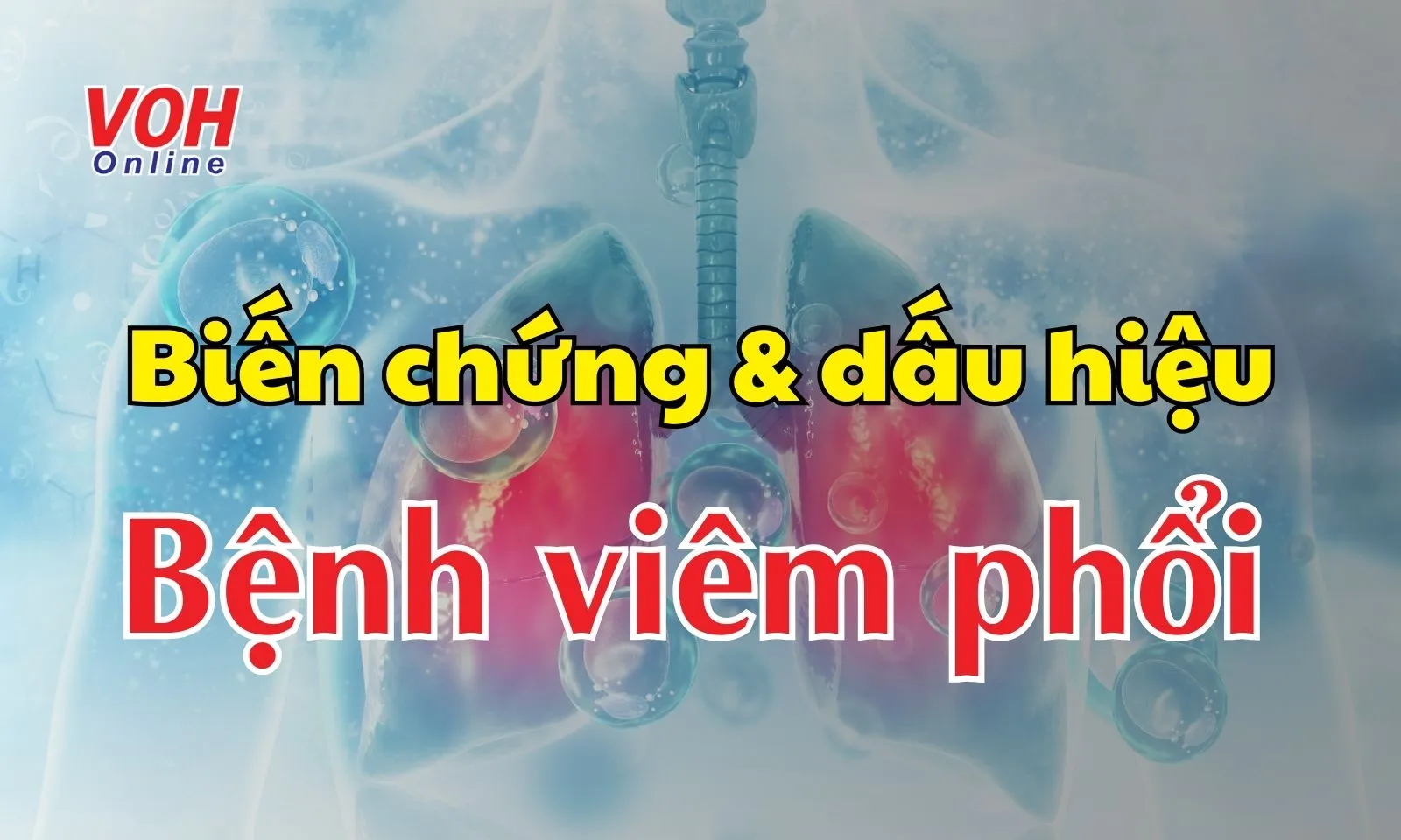 Những biến chứng nguy hiểm và dấu hiệu nhận biết bệnh viêm phổi