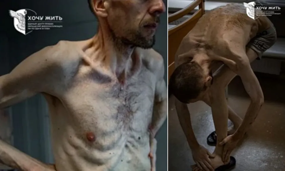 1/3 số tù binh Nga trao trả cho Ukraine bị ốm nặng hoặc tàn tật