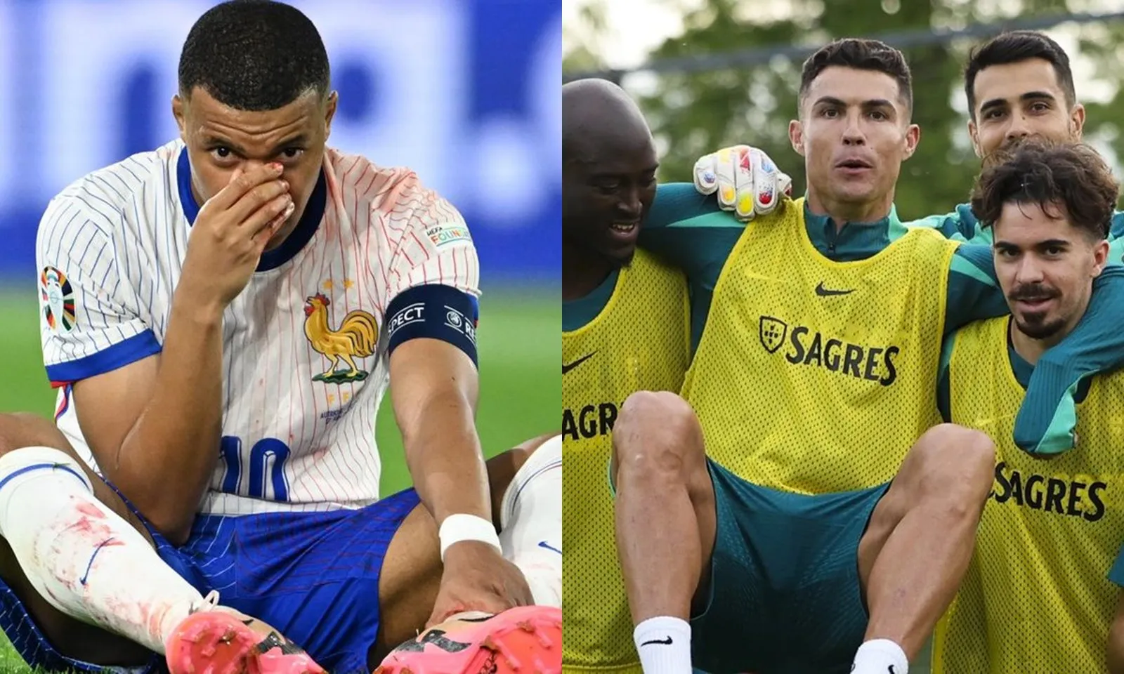 Chuyển động EURO 18/6: Mbappe gặp chấn thương kinh hoàng | Sao tuyển CH Séc lo sợ Ronaldo 