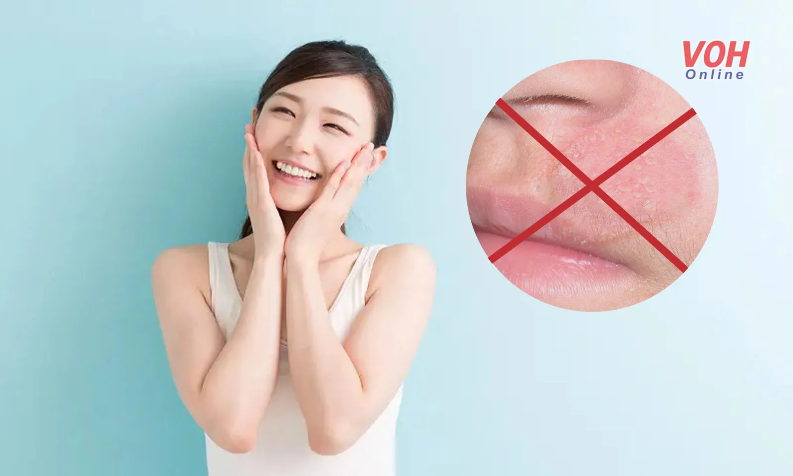 8 nguyên tắc phòng ngừa nấm da tái phát sau điều trị