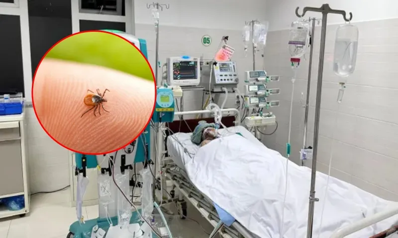 Người đàn ông suy đa tạng vì bị mò đốt 