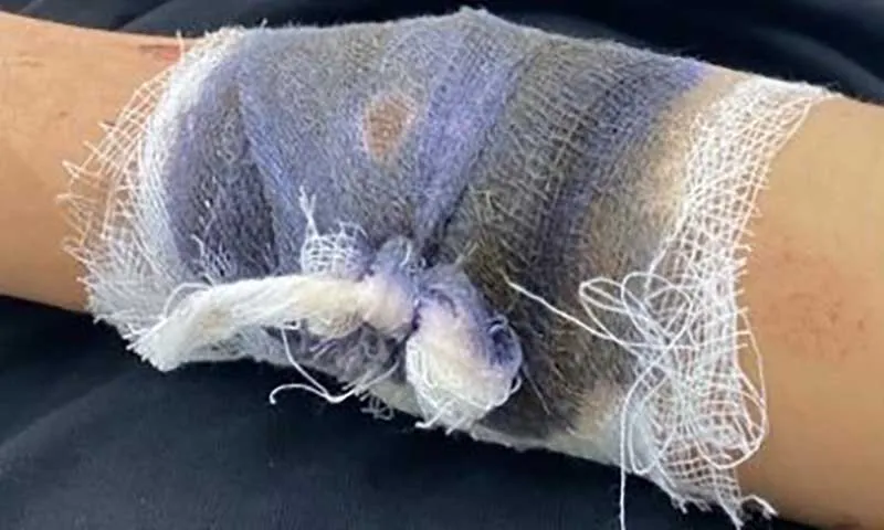 Dùng dao chém người, cướp xe máy gần Nhà hát lớn (Hà Nội)