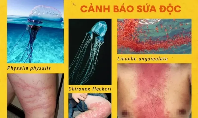 Nha Trang: Cảnh báo xuất hiện sứa lửa tại các bãi tắm biển  