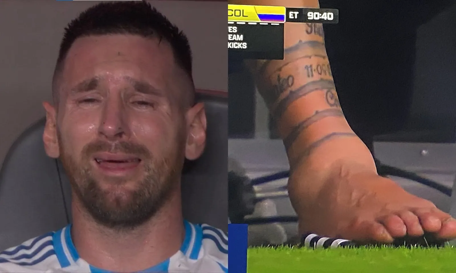 Cận cảnh chấn thương của Messi khiến CĐV xót xa