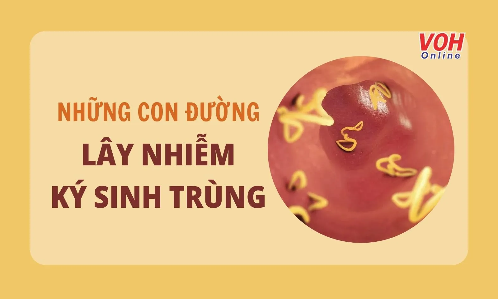 Những con đường lây nhiễm ký sinh trùng phổ biến