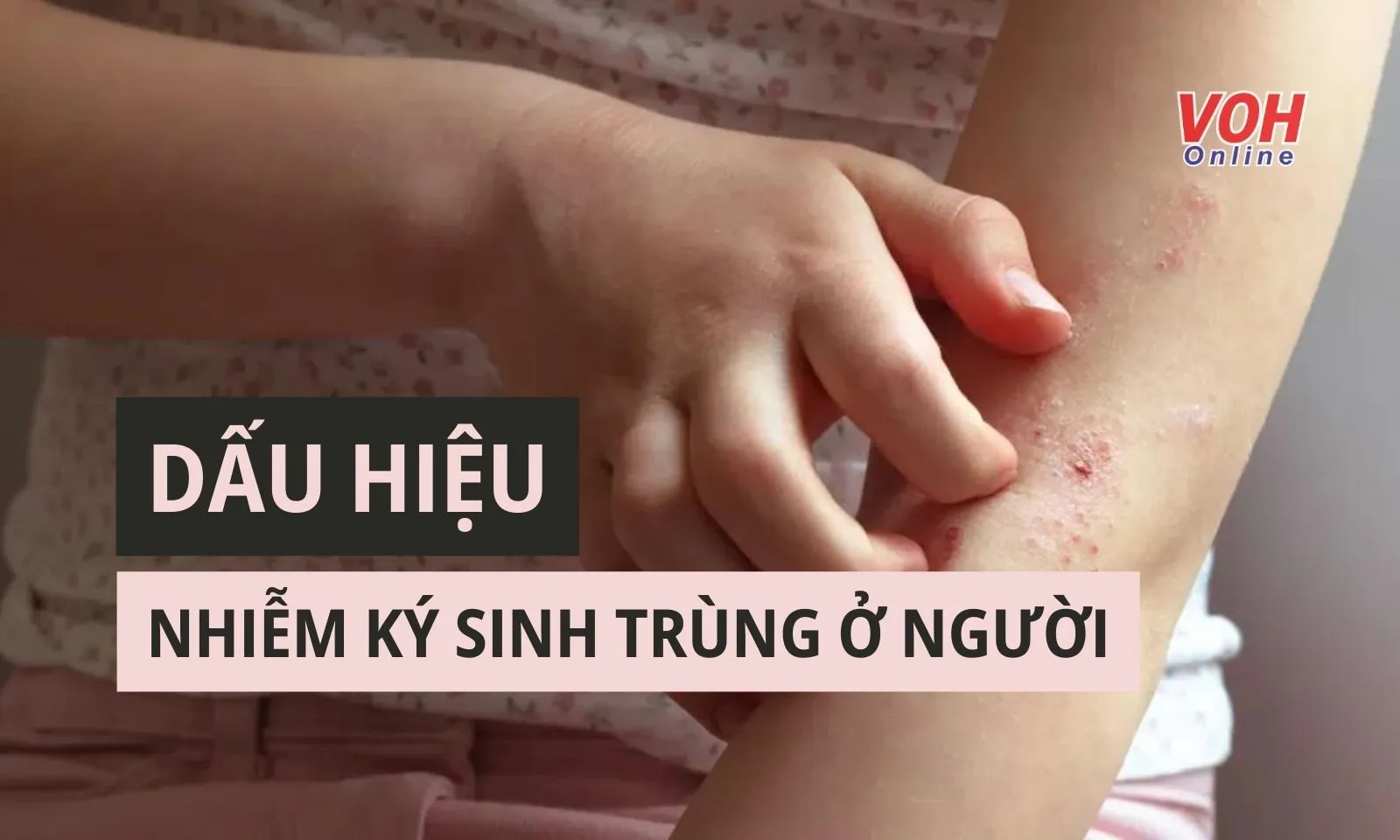 Dấu hiệu nhiễm ký sinh trùng ở người 