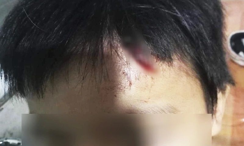 Khởi tố vụ án mẹ kế nghi bạo hành con riêng của chồng ở Cà Mau