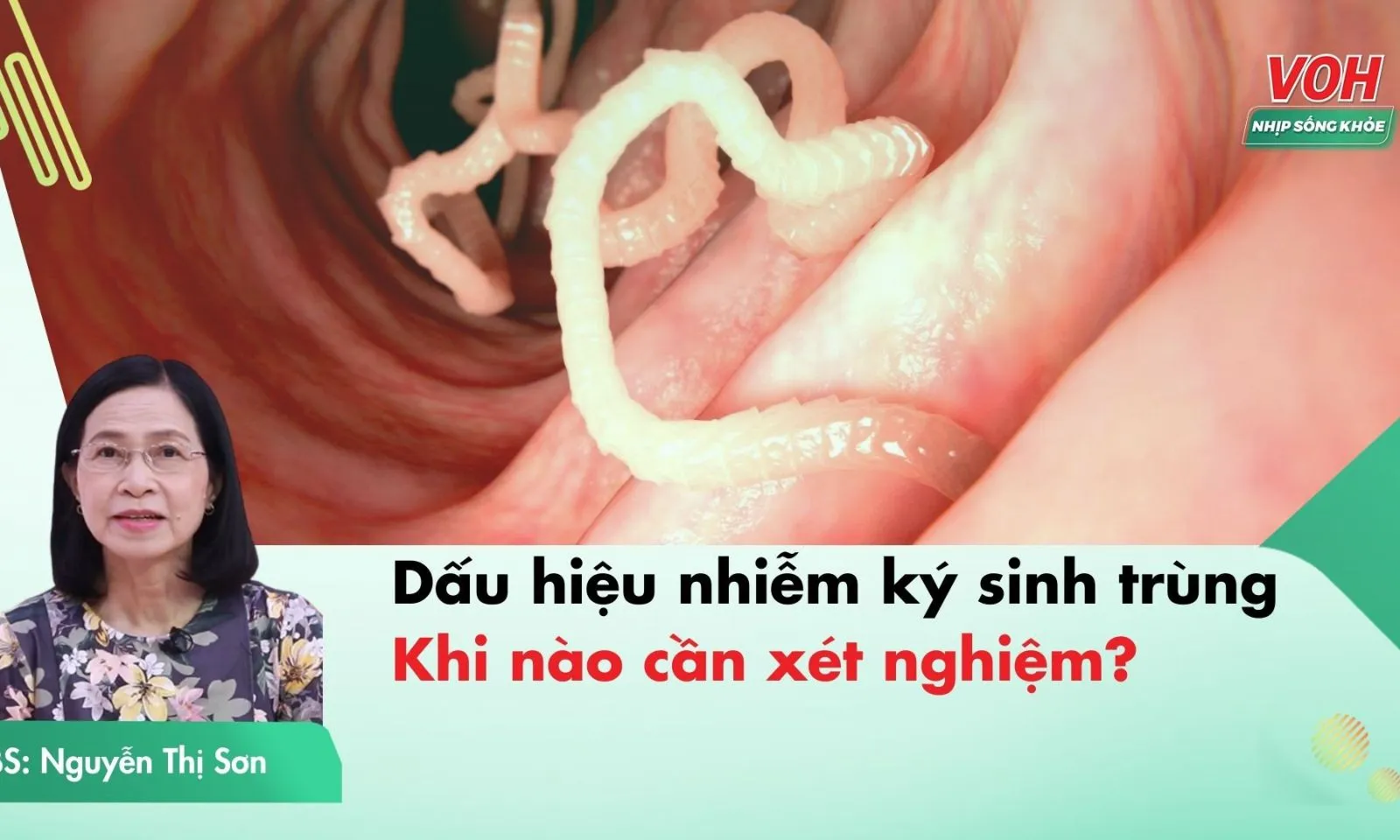 Khi nào cần xét nghiệm nhiễm ký sinh trùng?