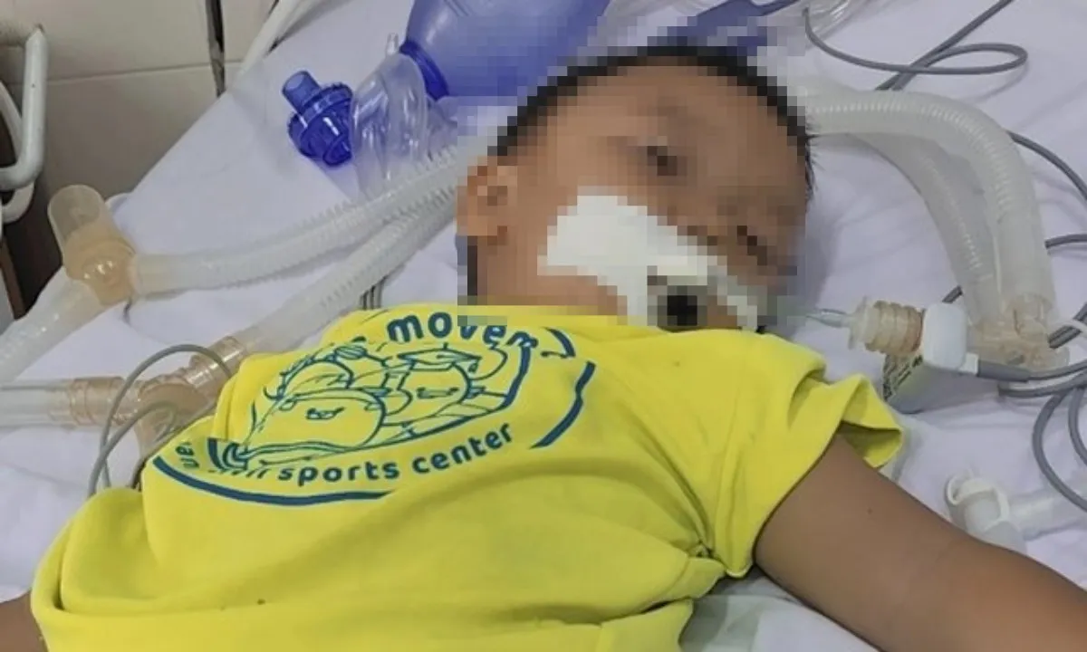Từ trường về nhà, bé trai 3 tuổi ở Khánh Hòa bị xuất huyết não
