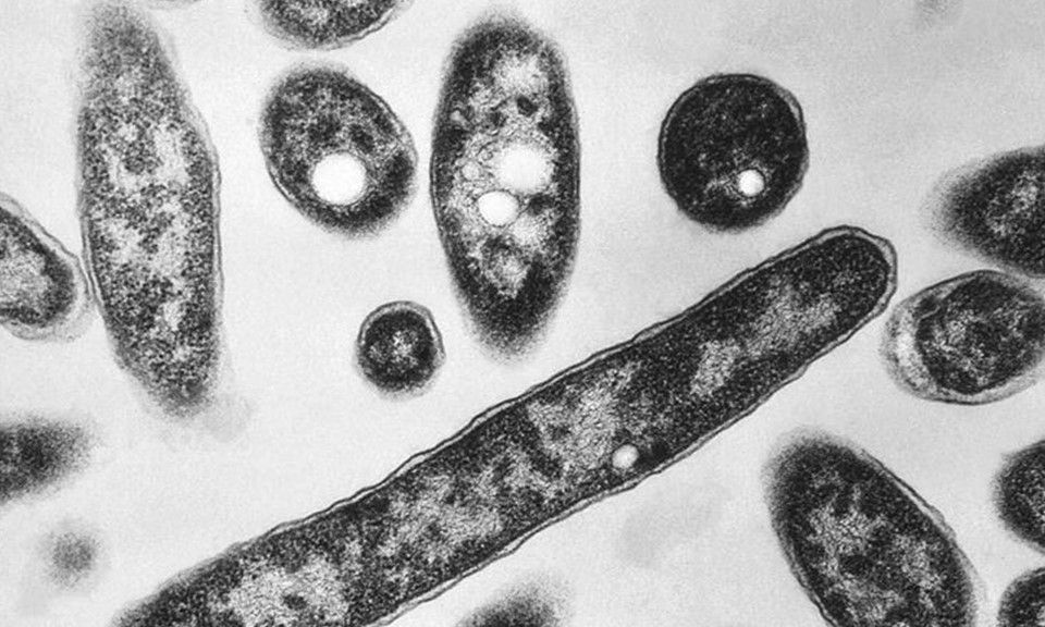 Australia: Xác định nguyên nhân gây ra đợt bùng phát bệnh Legionnaires khiến 2 người thiệt mạng
