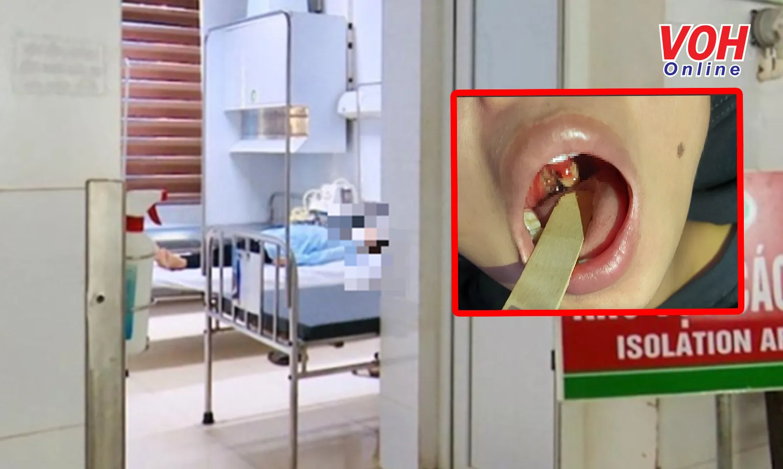 Thanh Hóa: Một thai phụ dương tính với bệnh bạch hầu chưa rõ nguồn lây 