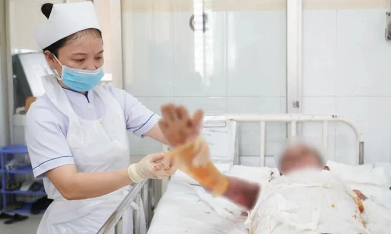Trượt chân khi bê nồi nước sôi 20 lít, nam thanh niên bỏng nặng