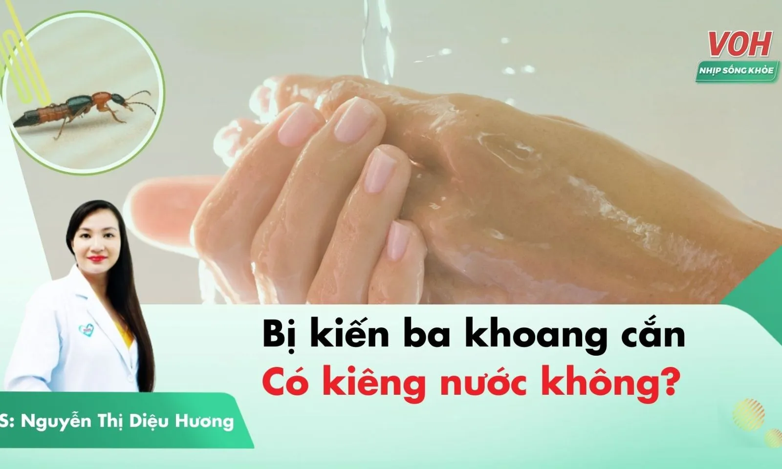 Bị kiến ba khoang cắn có được tắm không?