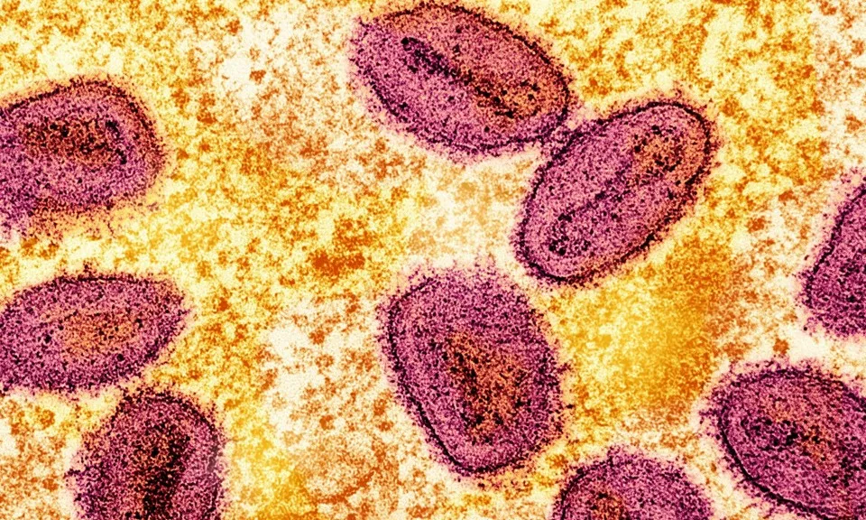 Philippines phát hiện ca bệnh mpox đầu tiên trong năm nay, chưa xác định được chủng loại