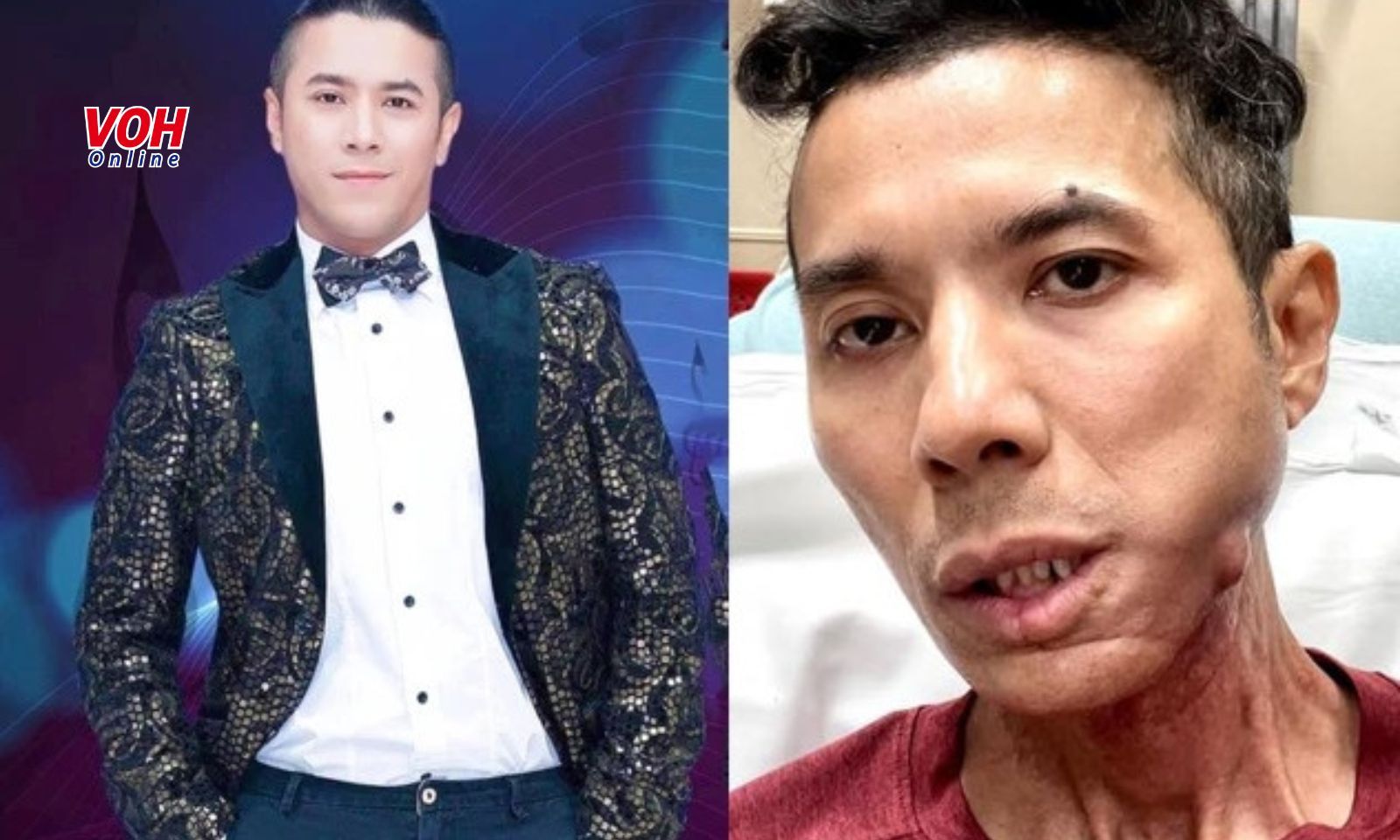 Diện mạo khác lạ của Kasim Hoàng Vũ cùng tin đồn anh qua đời