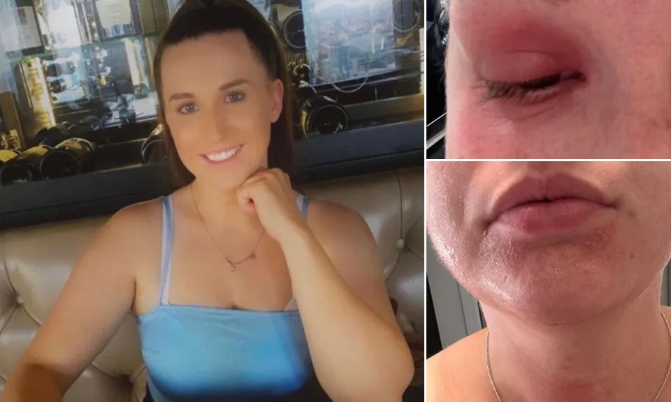 Cô gái khốn khổ vì bị dị ứng với chính chu kỳ kinh nguyệt của mình