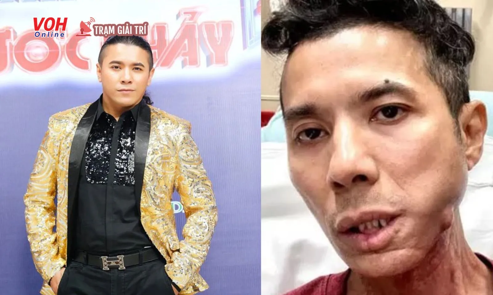 Kasim Hoàng Vũ phải nhập viện cấp cứu, sức khỏe và cuộc sống hiện ra sao?