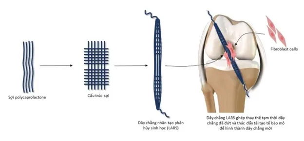 Phát triển thành công dây chằng polyme-3