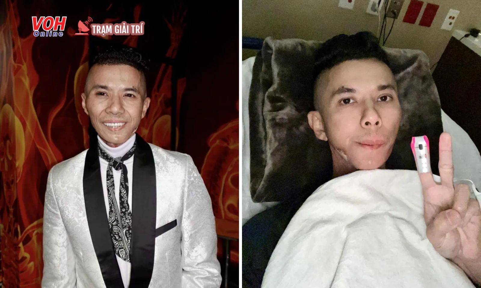 Kasim Hoàng Vũ nhập viện lần 2 sau khi nỗ lực hoàn thành đêm diễn