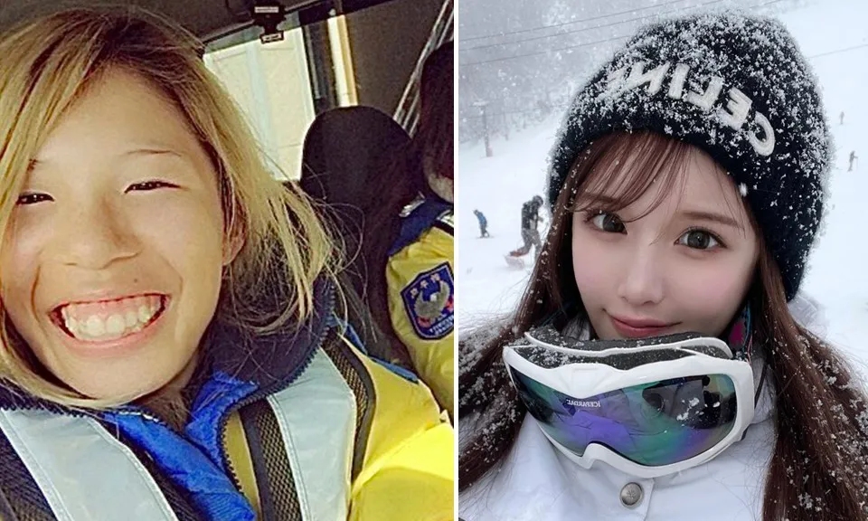 phau-thuat-tham-my-170924