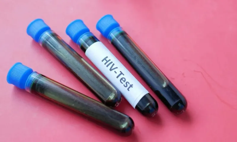 Ca nhiễm HIV ngoại tỉnh tăng mạnh tại TPHCM, chủ yếu trong nhóm đồng giới
