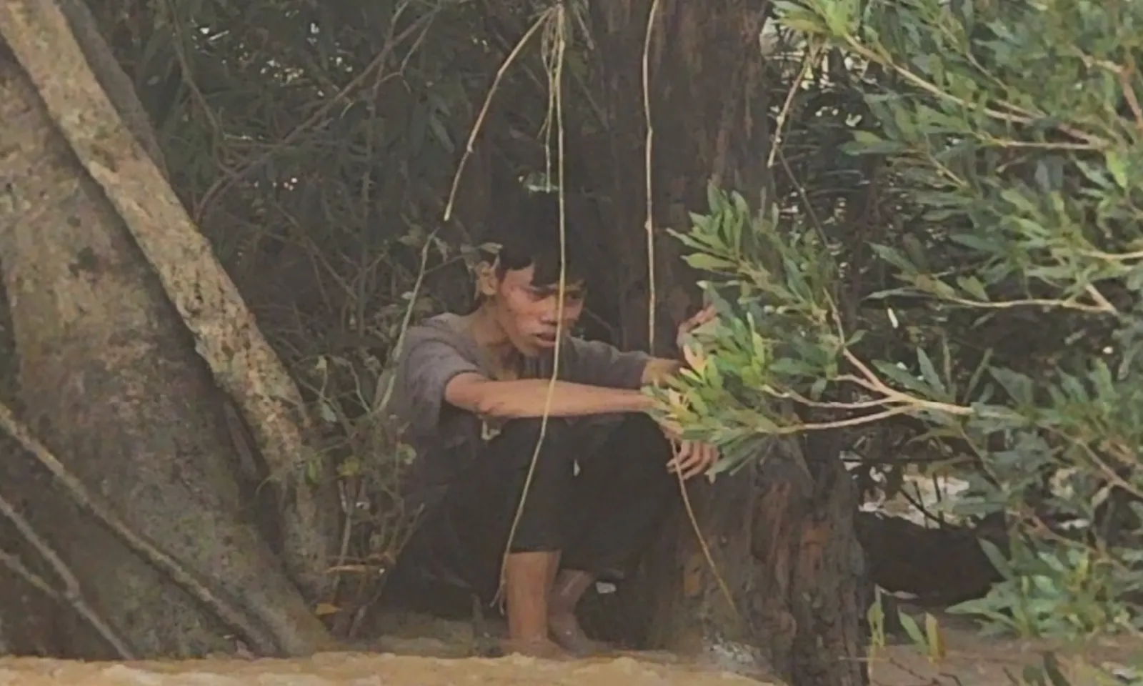 voh-benh-lien-cau-lon-la-gi-lay-sang-nguoi-qua-con-duong-nao-thumb (13)