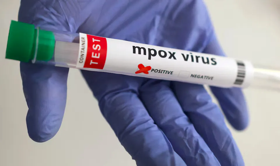 XEWJDMSOCJMM3HVGOIY246XSI4_jpg(1)