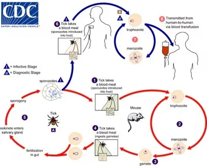 Bệnh babesiosis