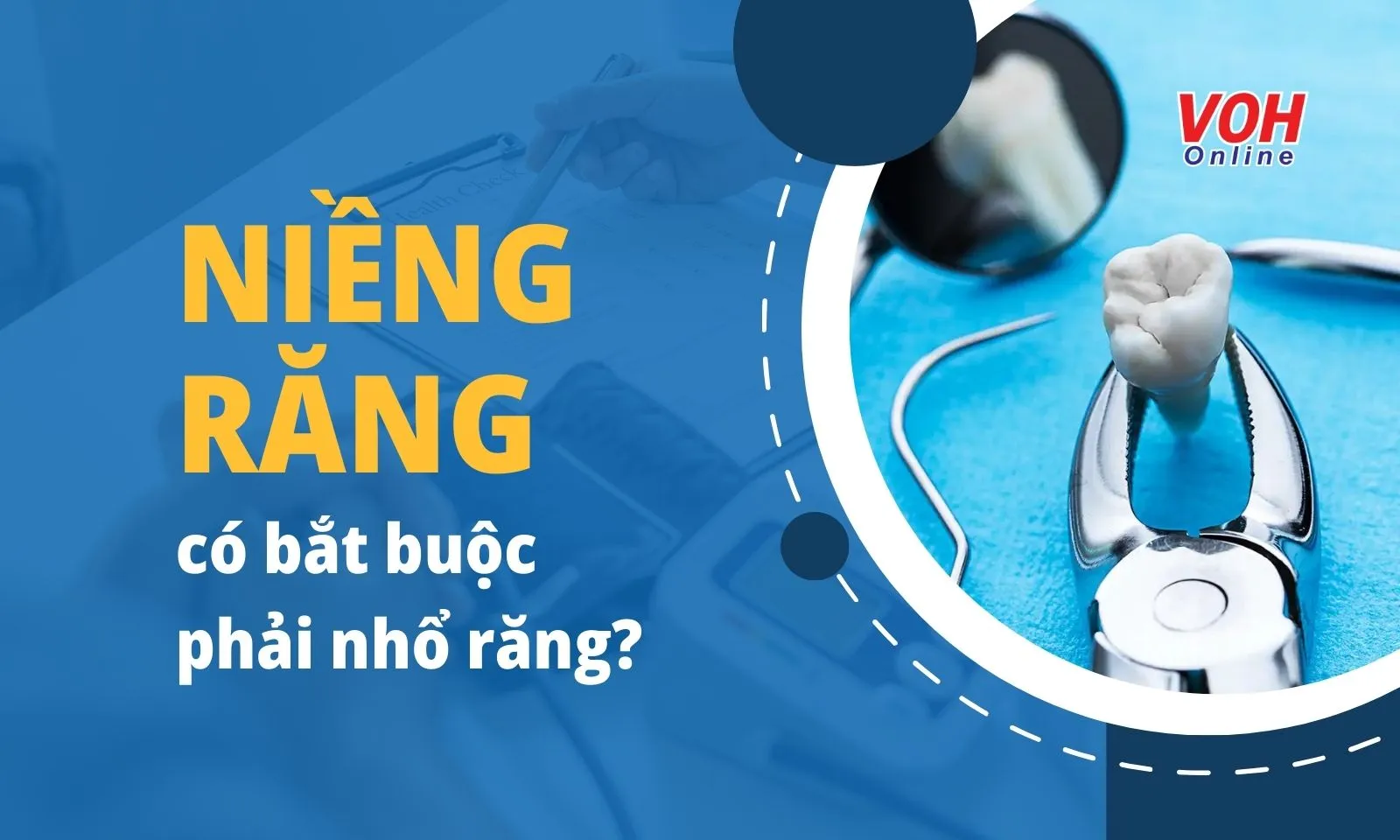 Niềng răng có bắt buộc phải nhổ răng không?