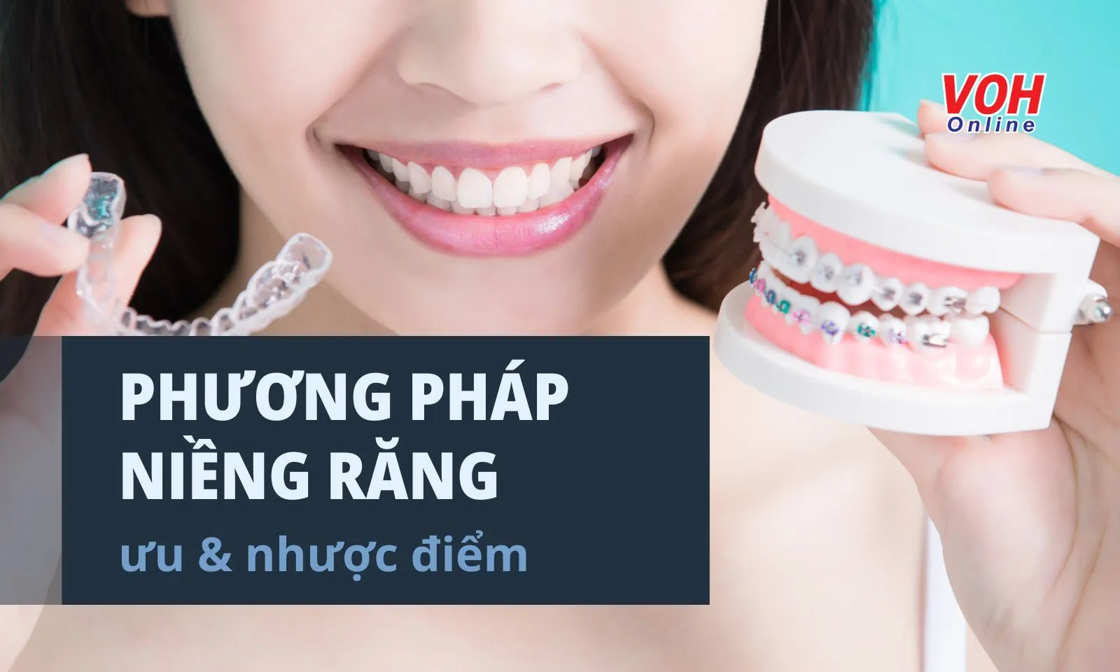 Có những phương pháp niềng răng nào? Quy trình niềng răng cần biết