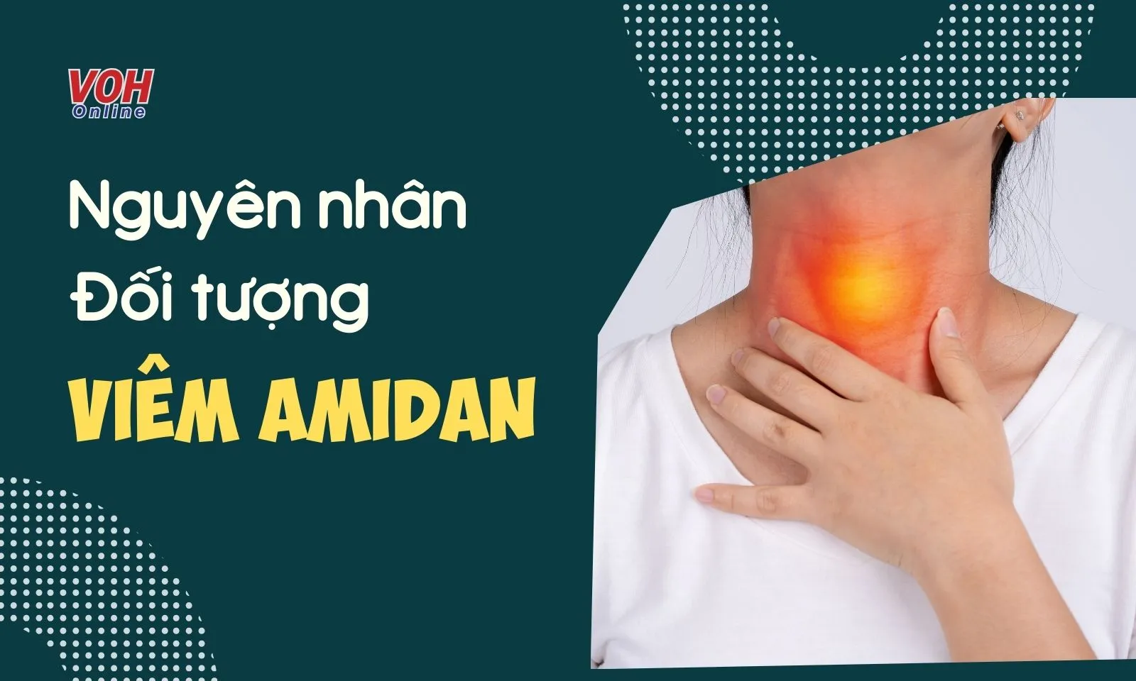  Viêm amidan là gì? Nguyên nhân và đối tượng có nguy cơ dễ mắc bệnh