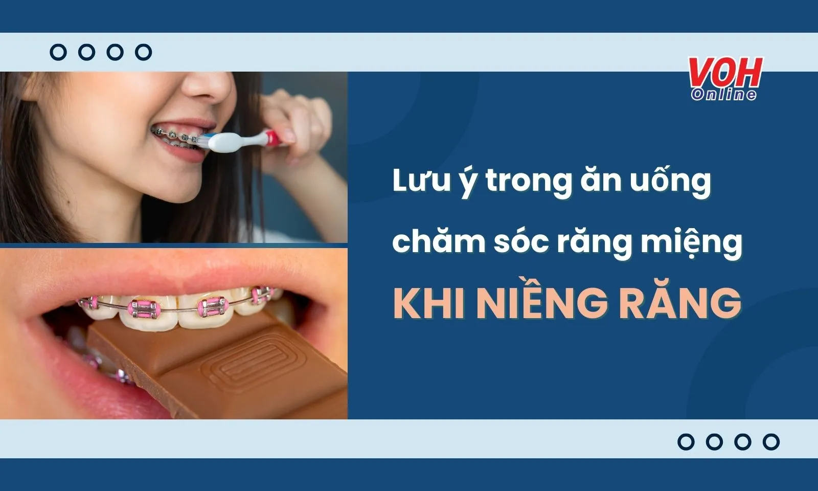 Người niềng răng nên ăn uống, chăm sóc răng miệng như thế nào?