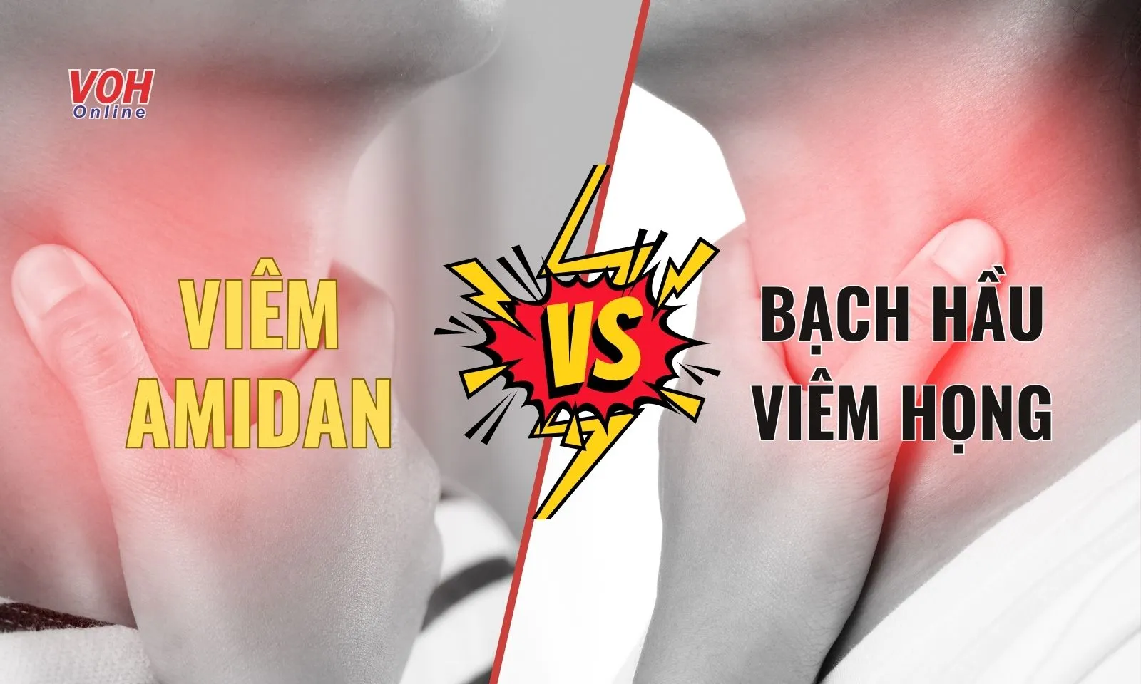 Cách phân biệt viêm amidan với bạch hầu, viêm họng