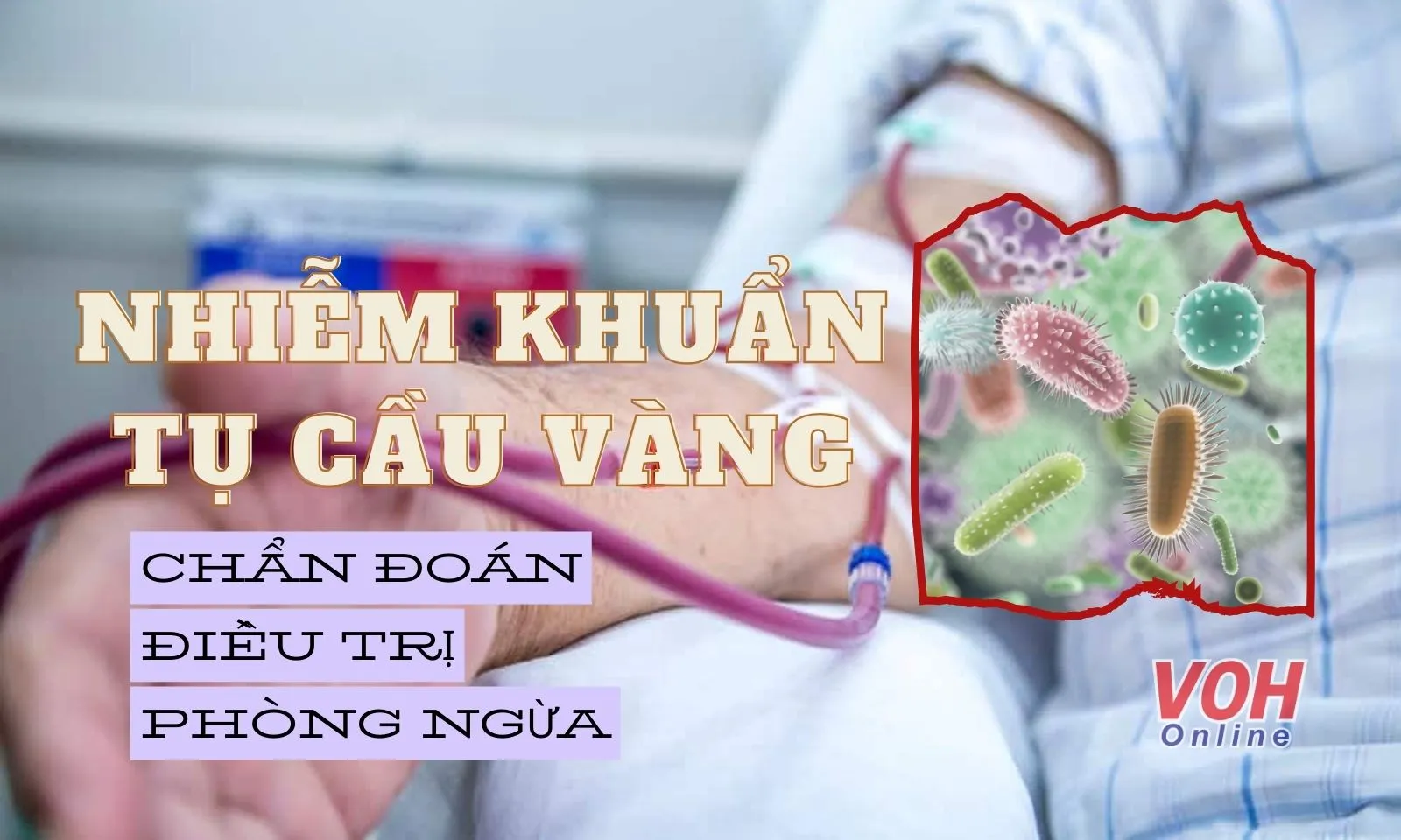 Phương pháp chẩn đoán, điều trị và phòng ngừa nhiễm khuẩn tụ cầu vàng