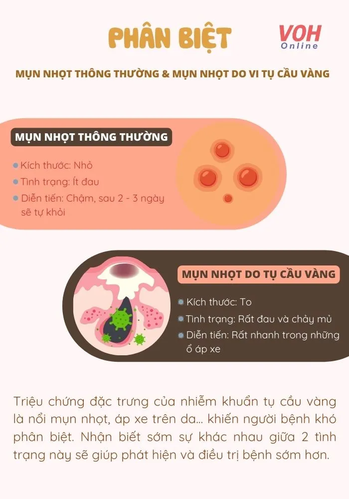 voh-phan-biet-nhiem-khuan-tu-cau-vang-va-mun-nhot