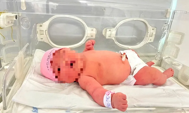 Đi chọn ngày đẹp để mổ đẻ, thai phụ bất ngờ khi con nặng gần 6kg