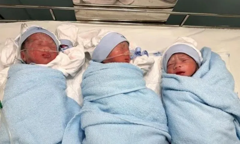 Kỳ tích đỡ đẻ thành công ca sinh 3 tự nhiên hiếm gặp tại Đồng Nai