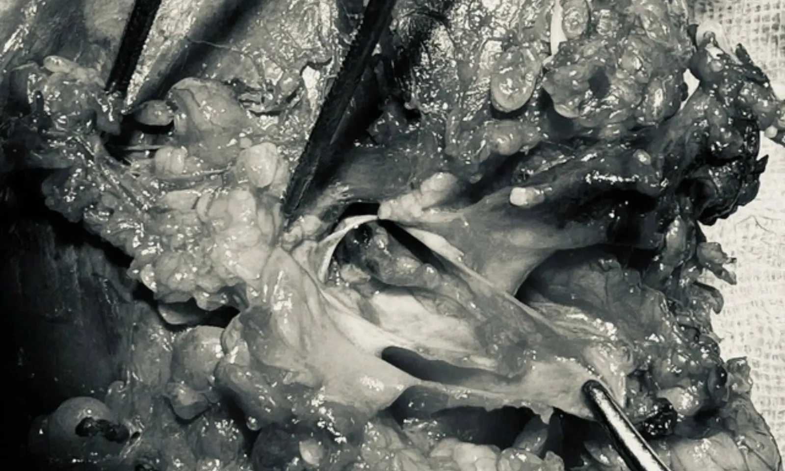 Bản sao của thumb liên cầu lợn (10)