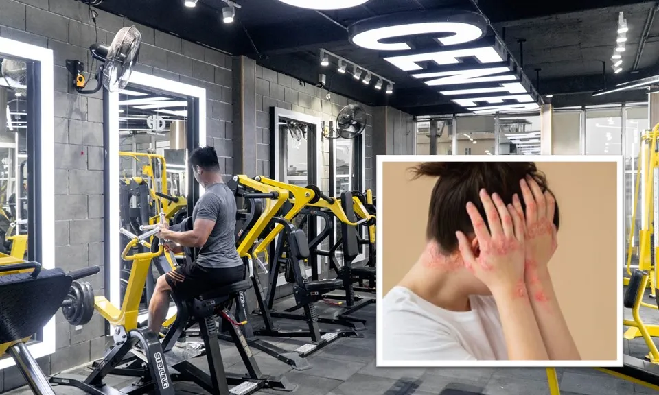 Phòng tập gym có thể là nơi lây nhiễm bệnh hắc lào