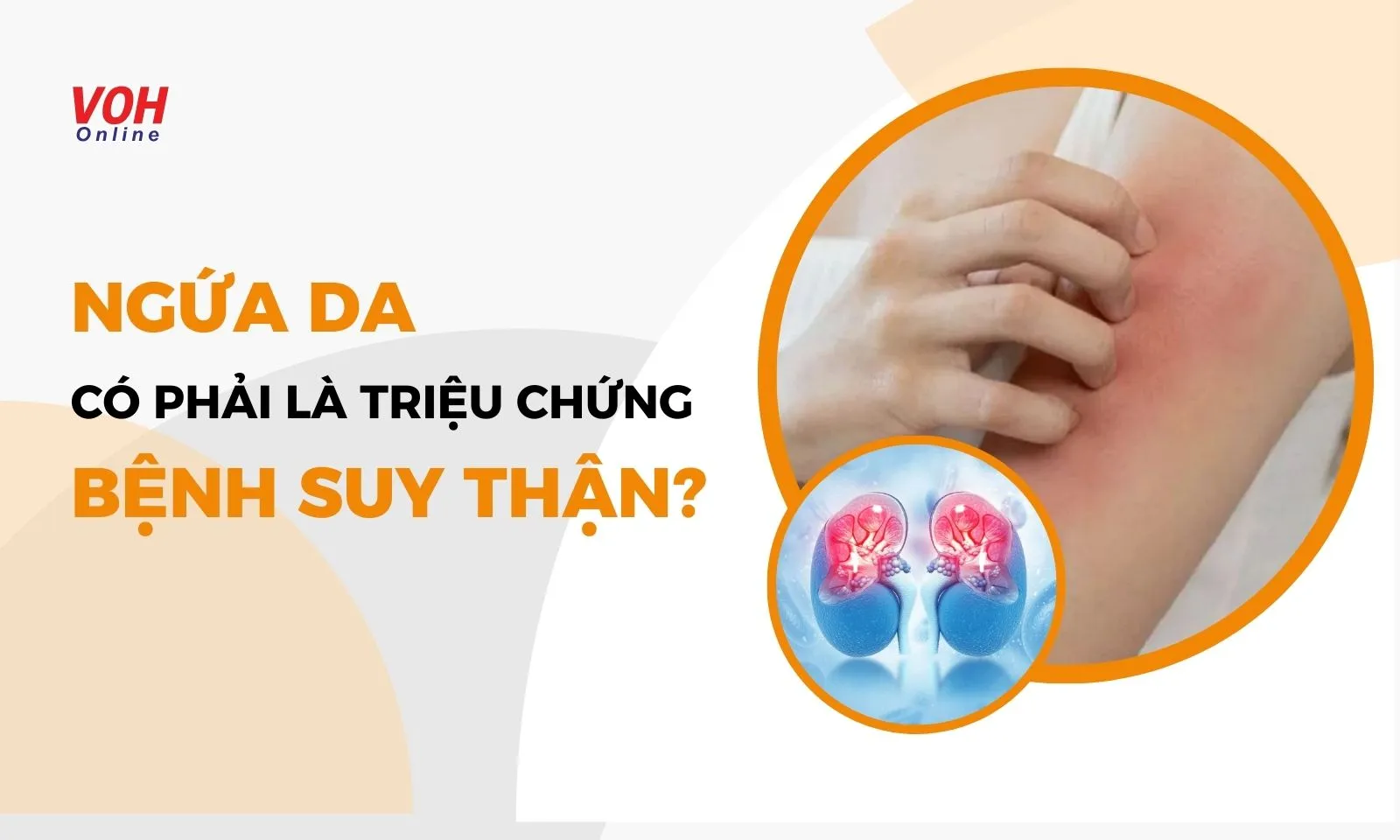 Ngứa da thường xuyên có phải là triệu chứng của suy thận?