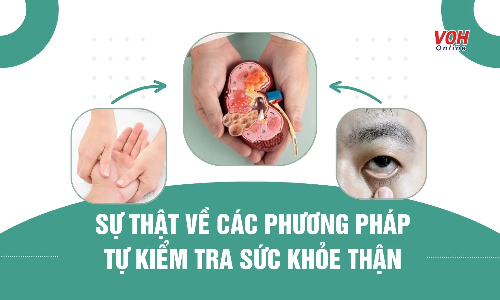 Tự kiểm tra sức khỏe thận tại nhà được truyền tai nhau, có đáng tin?