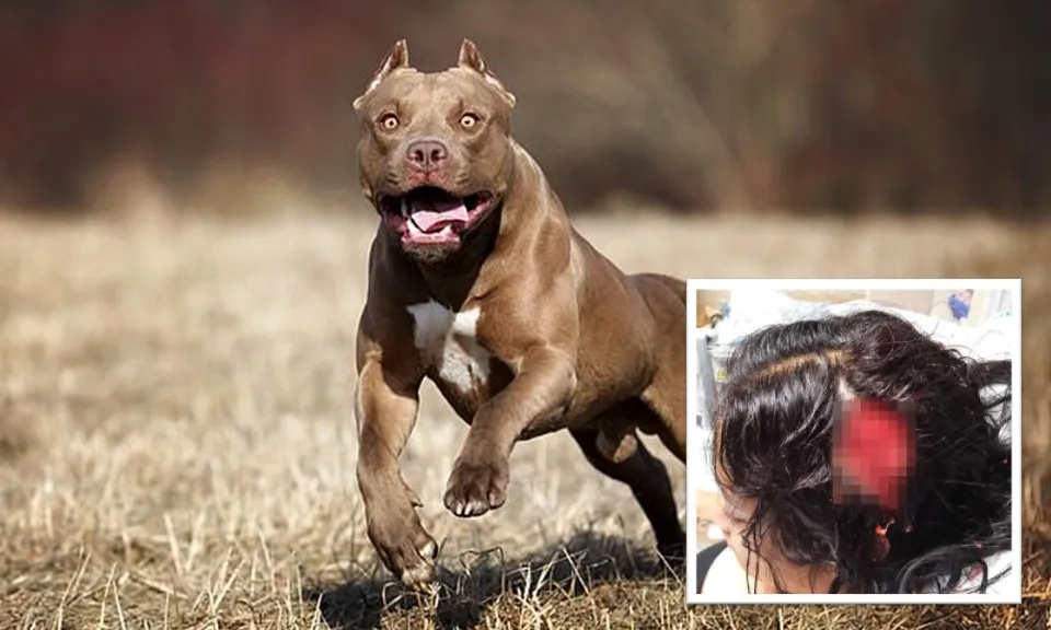 Người phụ nữ bị đàn chó Pitbull tấn công tàn bạo, mất một phần hộp sọ