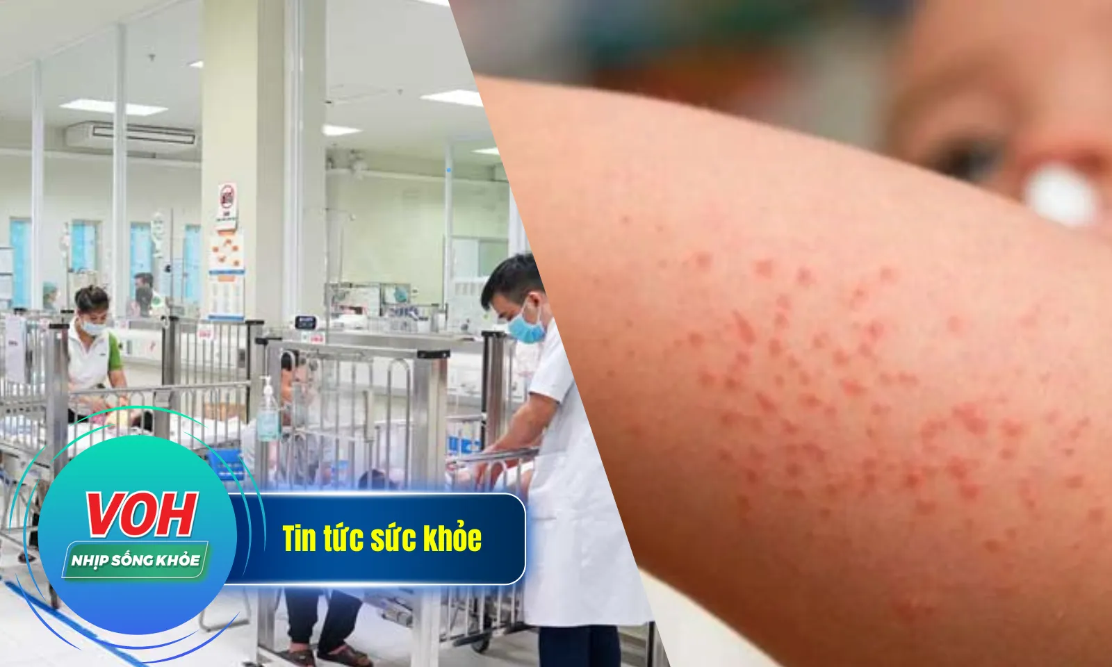 Nhịp Sống Khỏe 5/12: Hai bé ngộ độc do ăn nhầm lá hoa thủy tiên | Dịch sởi lan rộng ở miền Nam