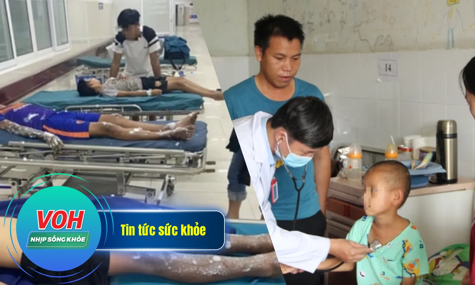 Nhịp Sống Khỏe 7/12: 4 học sinh bị bỏng nặng do tự chế pháo| Bé trai nguy kịch vì rắn cắn khi ngủ