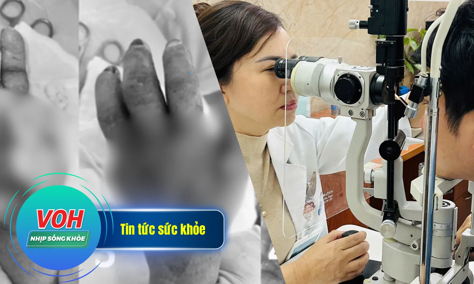 Nhịp Sống Khỏe 10/12:Người phụ nữ mất ngón tay vì vết ngứa nhỏ | Chấn thương mắt nặng vì pháo tự chế